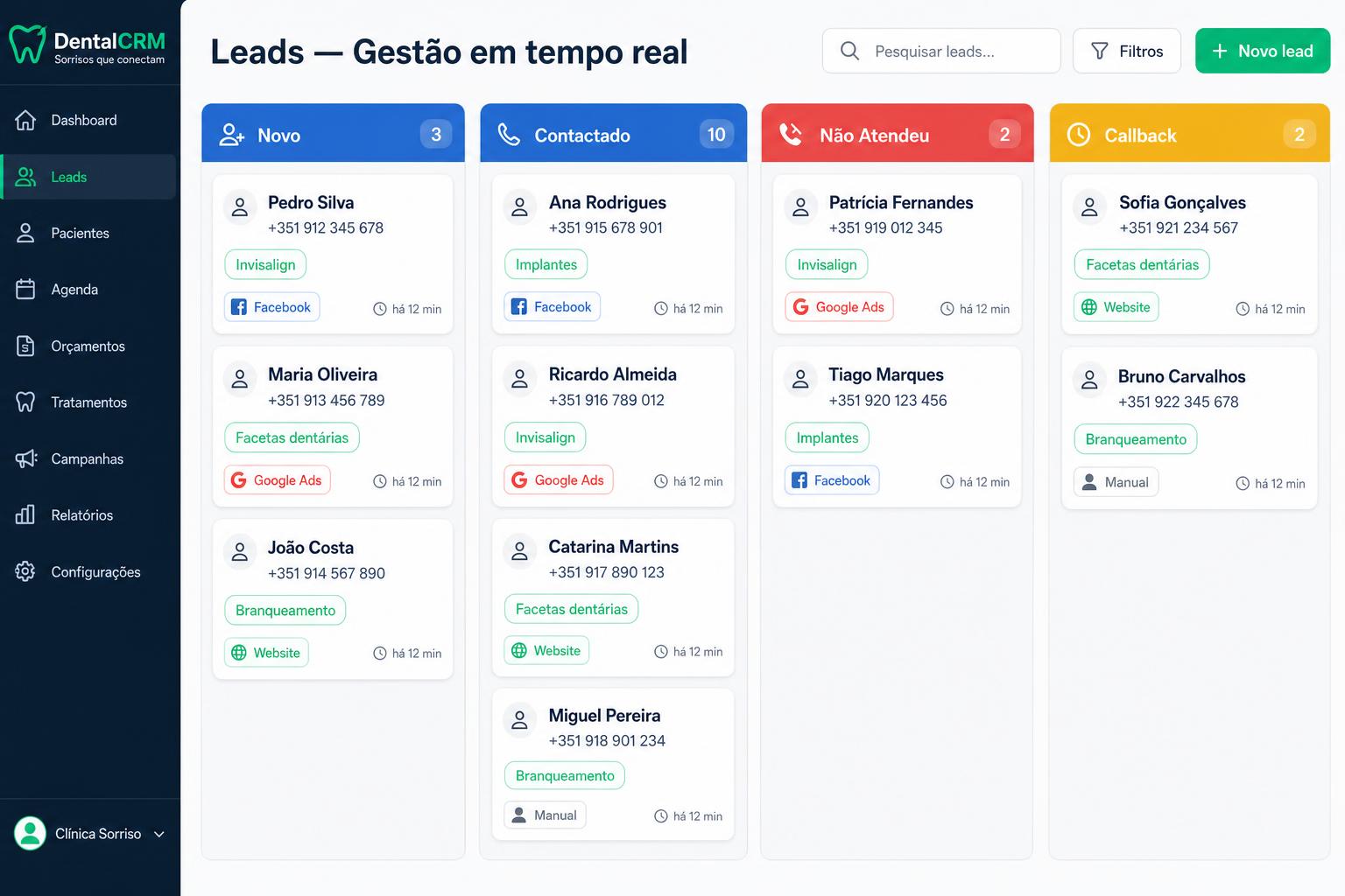 Kanban de gestão de leads